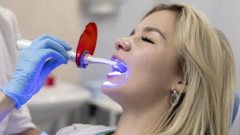 Was kostet Bleaching beim Zahnarzt? Preise, Methoden und alles, was du wissen musst was kostet bleaching beim zahnarzt